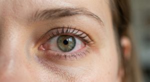 10 Signs Your Eyes Could Reveal Chronic Inflammation — What To Watch For In 2026